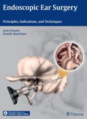 book Endoscopic ear surgery : principles, indications, and techniques