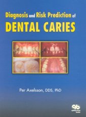 book Diagnosis and Risk Prediction of Dental Caries, Volume 2