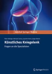 book Künstliches Kniegelenk: Fragen an die Spezialisten