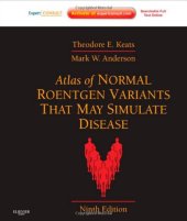 book Atlas of Normal Roentgen Variants That May Simulate Disease