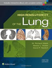 book High-Resolution CT of the Lung