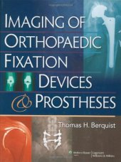 book Imaging of Orthopaedic Fixation Devices and Prostheses