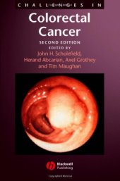 book Challenges in colorectal cancer