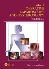 book Atlas of operative laparoscopy and hysteroscopy