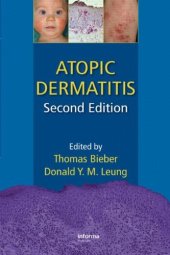 book Atopic dermatitis