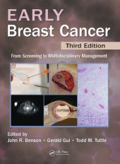 book Early breast cancer : from screening to multidisciplinary management