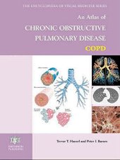 book An atlas of chronic obstructive pulmonary disease, COPD