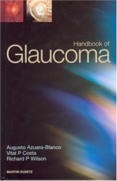 book Handbook of glaucoma