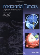 book Intracranial tumors : diagnosis and treatment