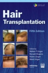 book Hair transplantation