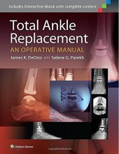 book Total ankle replacement : an operative manual