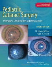 book Pediatric cataract surgery : techniques, complications, and management