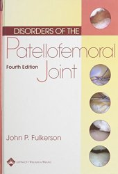 book Disorders of the patellofemoral joint