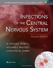 book Infections of the central nervous system