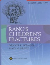 book Rang's children's fractures