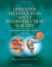 book Operative Techniques in Adult Reconstruction Surgery