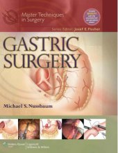 book Gastric Surgery