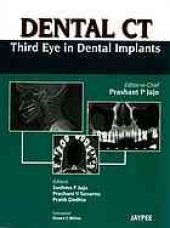 book Dental CT: Third Eye in Dental Implants