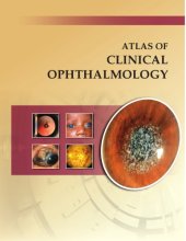 book Atlas of Clinical Ophthalmology