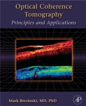 book Optical coherence tomography : principles and applications