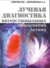 book Лучевая диагностика интерстициальных заболеваний лёгких