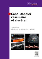 book Echo-doppler Vasculaire Et Viscřal