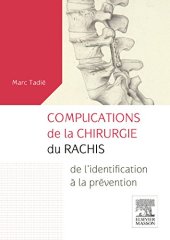 book Les complications de la chirurgie du rachis : de l'identification à la prévention