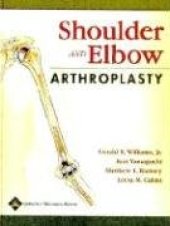 book Shoulder and Elbow Arthroplasty