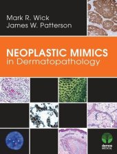 book Neoplastic Mimics in Dermatopathology