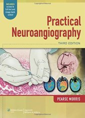 book Practical Neuroangiography