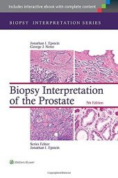 book Biopsy Interpretation of the Prostate