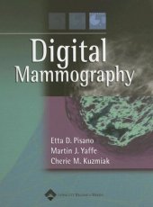 book Digital Mammography