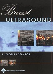 book Breast Ultrasound