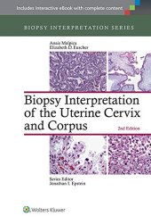 book Biopsy Interpretation of the Uterine Cervix and Corpus