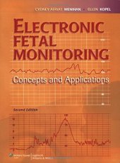 book Electronic Fetal Monitoring: Concepts and Applications