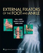 book External Fixators of the Foot and Ankle