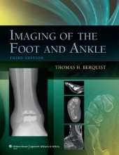 book Imaging of the Foot and Ankle