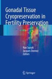 book Gonadal Tissue Cryopreservation in Fertility Preservation