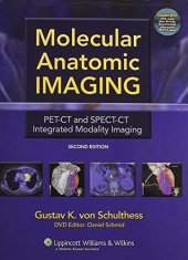 book Molecular Anatomic Imaging: PET-CT and SPECT-CT Integrated Modality Imaging