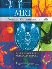 book MRI Normal Variants and Pitfalls