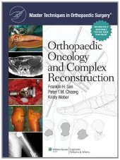 book Master Techniques in Orthopaedic Surgery: Orthopaedic Oncology and Complex Reconstruction