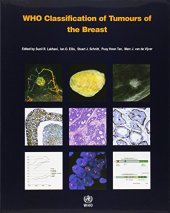 book WHO Classification of Tumours of the Breast