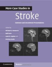 book More Case Studies in Stroke: Common and Uncommon Presentations