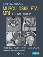 book Musculoskeletal MRI