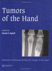 book Tumors of the hand