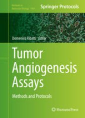 book Tumor Angiogenesis Assays: Methods and Protocols