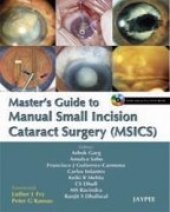 book Masters Guide to Manual Small Incision