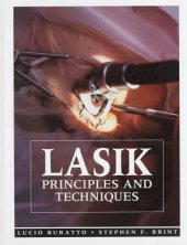 book LASIK: Principles and Techniques