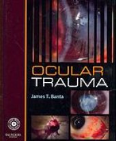 book Ocular trauma