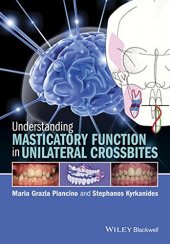 book Understanding masticatory function in unilateral crossbites